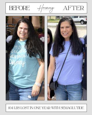 Before and After-- 104 pounds lost in a year with semaglutide.