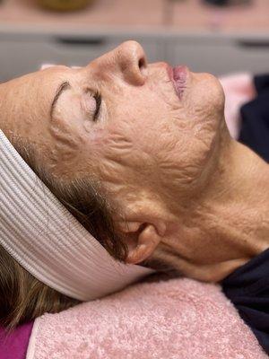 Caviar Facial for clients looking to Age SMART