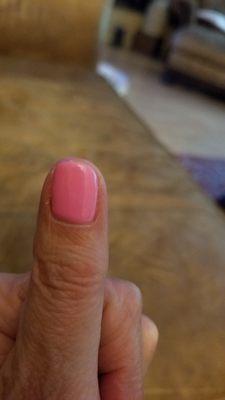 See how short my nail is and the cut along my cuticles. Ugh!