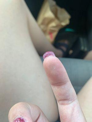 nothing done about this globed mess on the bottom of my nail.