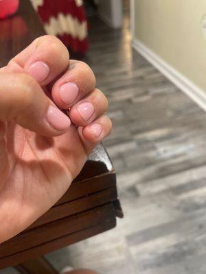 Cuticles sticking out