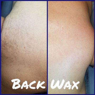 Male Back Wax