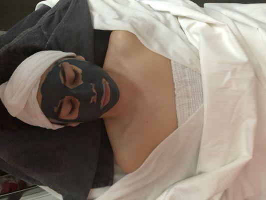 Charcoal and tea tree mask to draw impurities out on teen acne prone skin