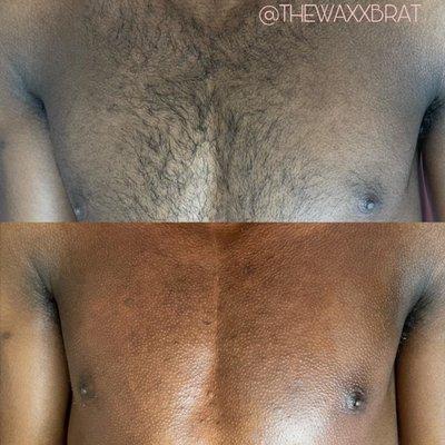 Chest Wax