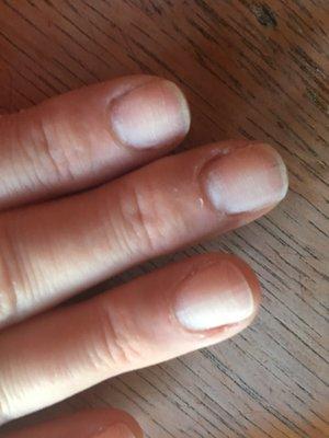 Very bad manicure. Notice the deep groves in my nails that catch on everything