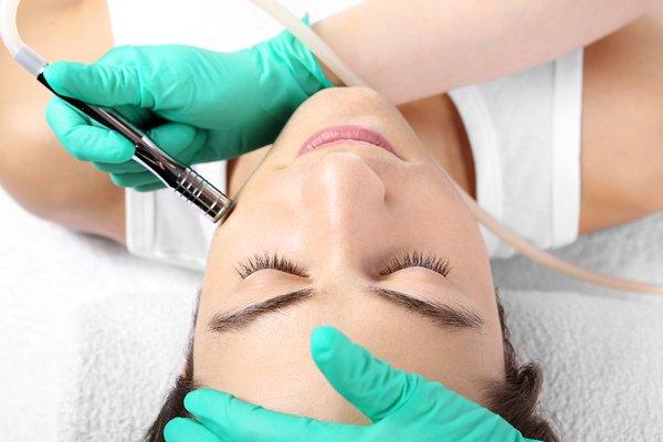 Microdermabrasion Treatment