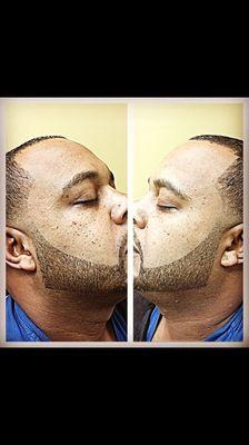 Blow-Outt w/ Beard Line Up