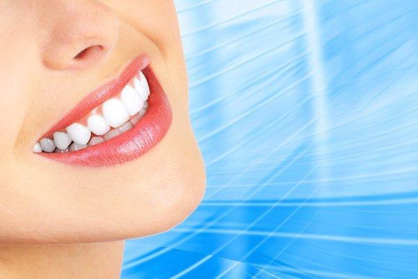 Dental Veneers