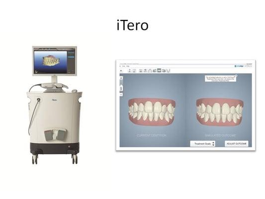 digital impression scanner no more messy goo