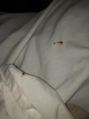 The remains of a squished bed bug