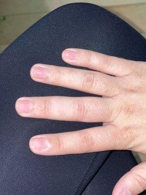 Th proof of a bad manicure!