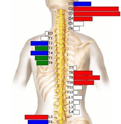 Nervous System scan showing areas of nerve interference.