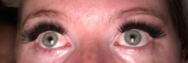 Eyes were super irritated and red as you can see. Hurts to close my eyes. Eyes be watery all the time. I NEED TO TAKE THESE OFF AND I CANT.