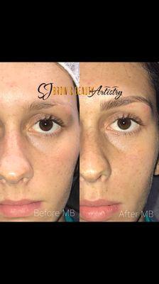 Before and after microblading