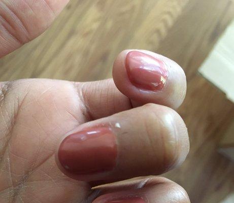 Bad cuticle removal by manicurist Oanh.