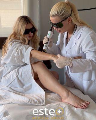 Laser hair removal