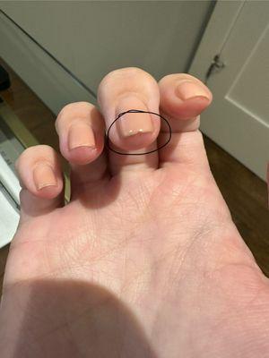 Nail chipping after 6 days