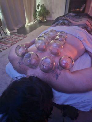 Fire cupping