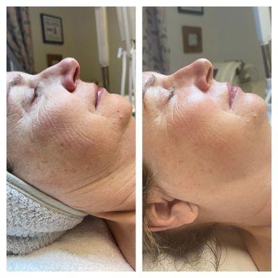 Firming peptide mask facial from Circadia!