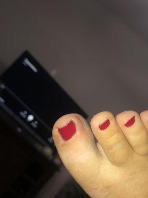 Contracted an infection from their pedicurist. Have never in my whole life had anything like this happen to me.