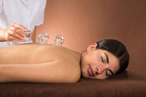 Acupuncture Continuum Encinitas cupping.