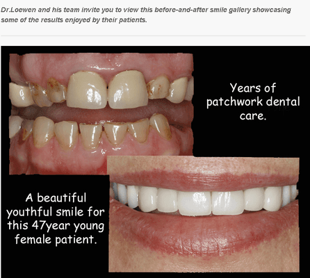 Before & after photo