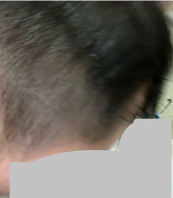 Badly messed up fade line. Actually there is no fade, she just buzzed everything below that blotch of hair.