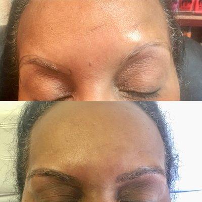 Microblading