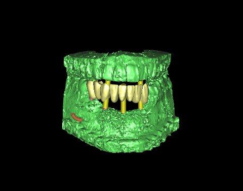 Latest CT technology and  digital planning for advanced care