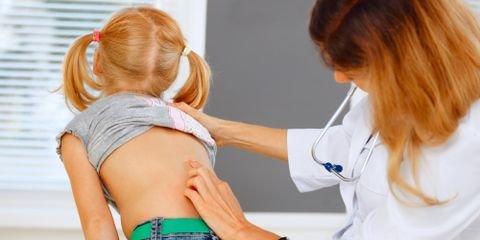 4 FAQs About Scoliosis