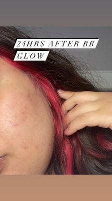 Bb glow facial