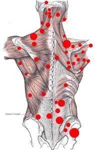 Trigger Point Chart