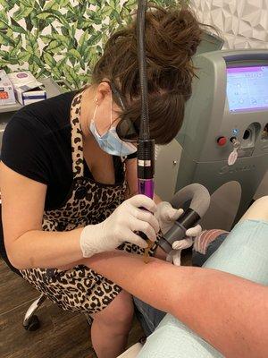 Owner & CAE Sarah Inloes performing a tattoo removal treatment.