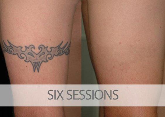 Example of Client Treatment After Six Sessions