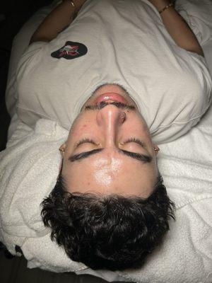 Acne Facial