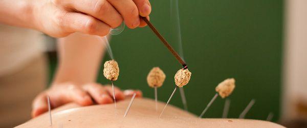 Matz Acupuncture