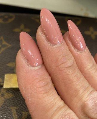 Cracks under the nails and covered with three coats of gel polish to cover it up.