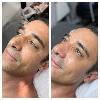 Hollywood Actor, Mr. Gilles Marini after his favorite Gravitas Megalux Treatment. He said "You made me look 10 years  younger!"