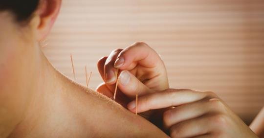 Acupuncture for improving several disorders