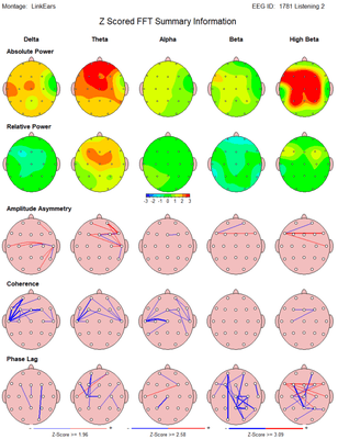 This is a statistical brain map that we use to identify why people have the problems they describe, and to "target" neurofeedback.