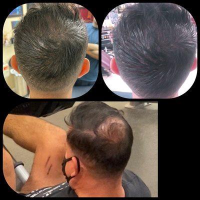 Some pmu.. Work on his bald spot was done 1 session. Fill in the gaps with hair strokes