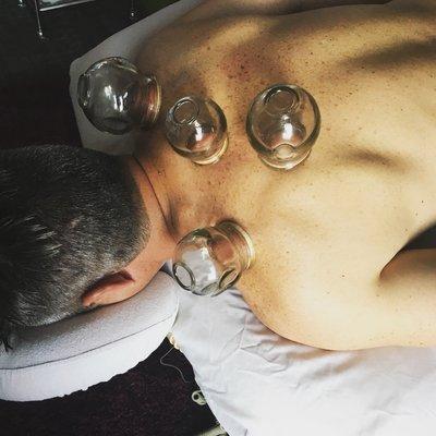 Cupping service