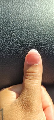 Left thumb nail...