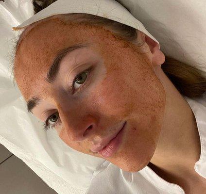 Chemical peel