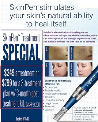 March 2016 special on skinpen!! What a deal!