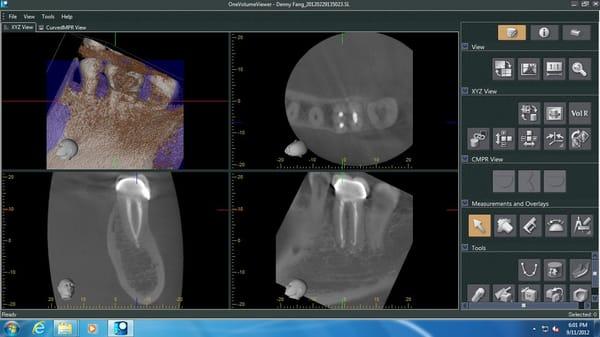 see your teeth in 3D