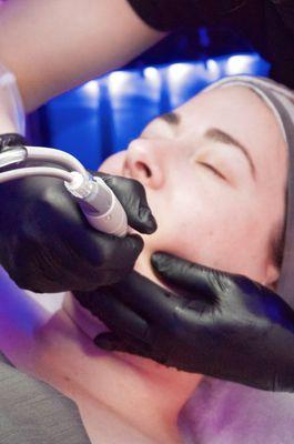 Hydrafacial