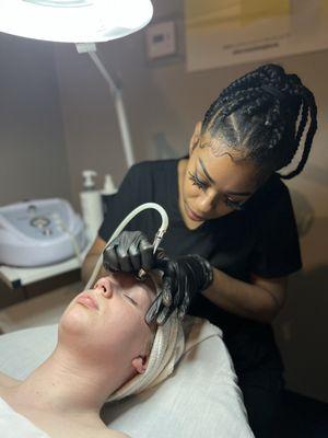 Microdermabrasion facial