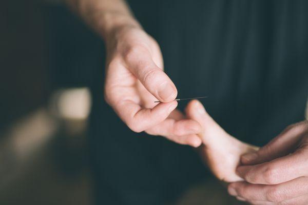 Japanese acupuncture includes non-insertive techniques - meaning the acupuncture point can be treated without inserting the needle at all.