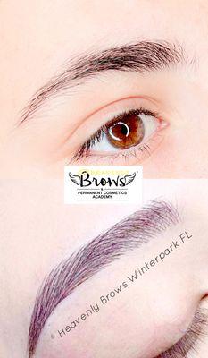 MicroBlading